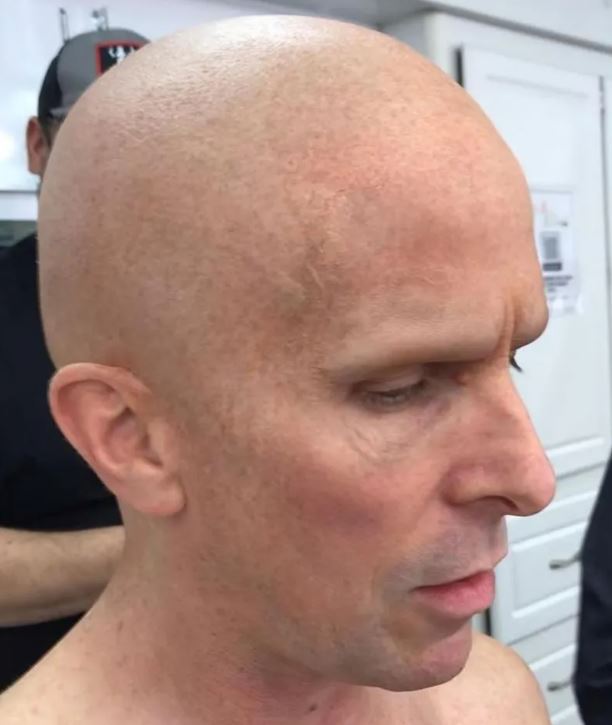Christian Bale’s Gorr Makeup – New Pictures Revealed